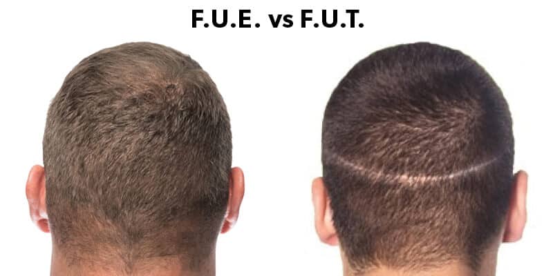 fue_vs_fut_v3