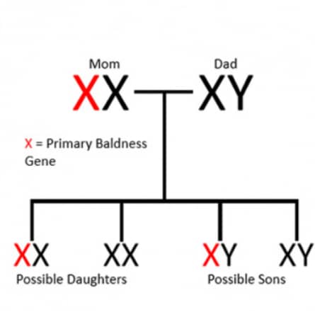 baldness gene