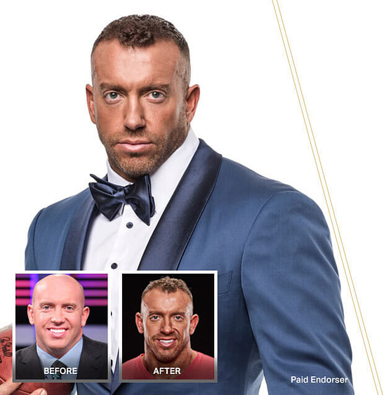 Heath Evans before/after