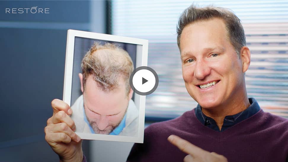 Danny Kanell before/after