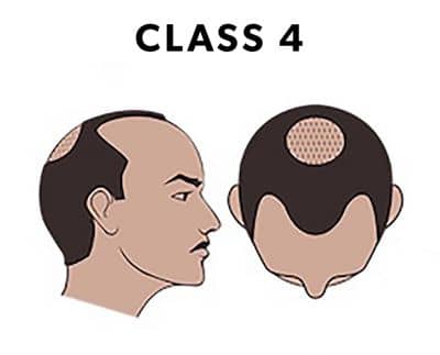 Class 4