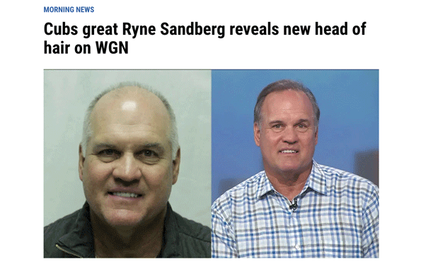 Ryne Sandberg's Story  RESTORE Hair 